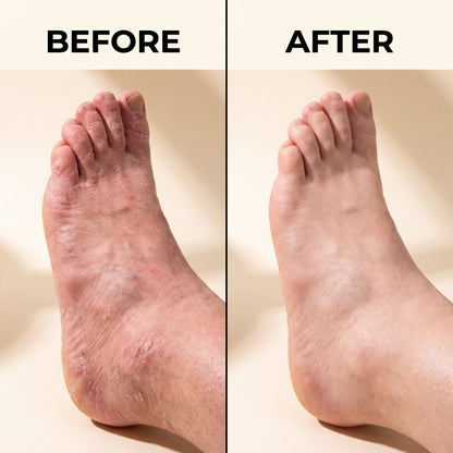 Anti-Fungal Skin Soap