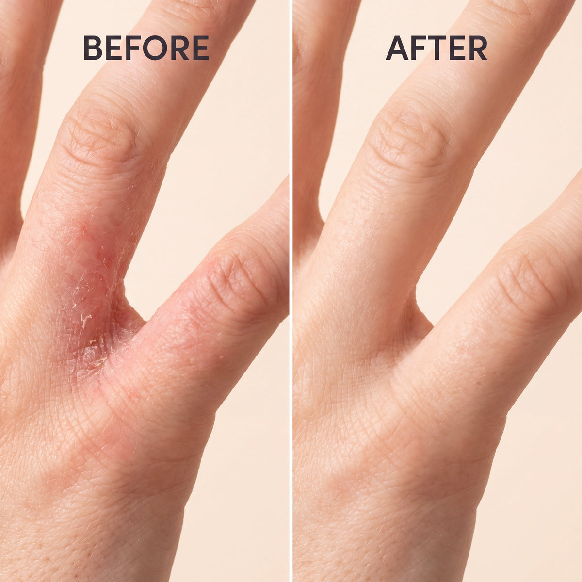 Anti-Fungal Skin Soap