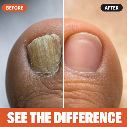 Nail Fungal Repair Patches