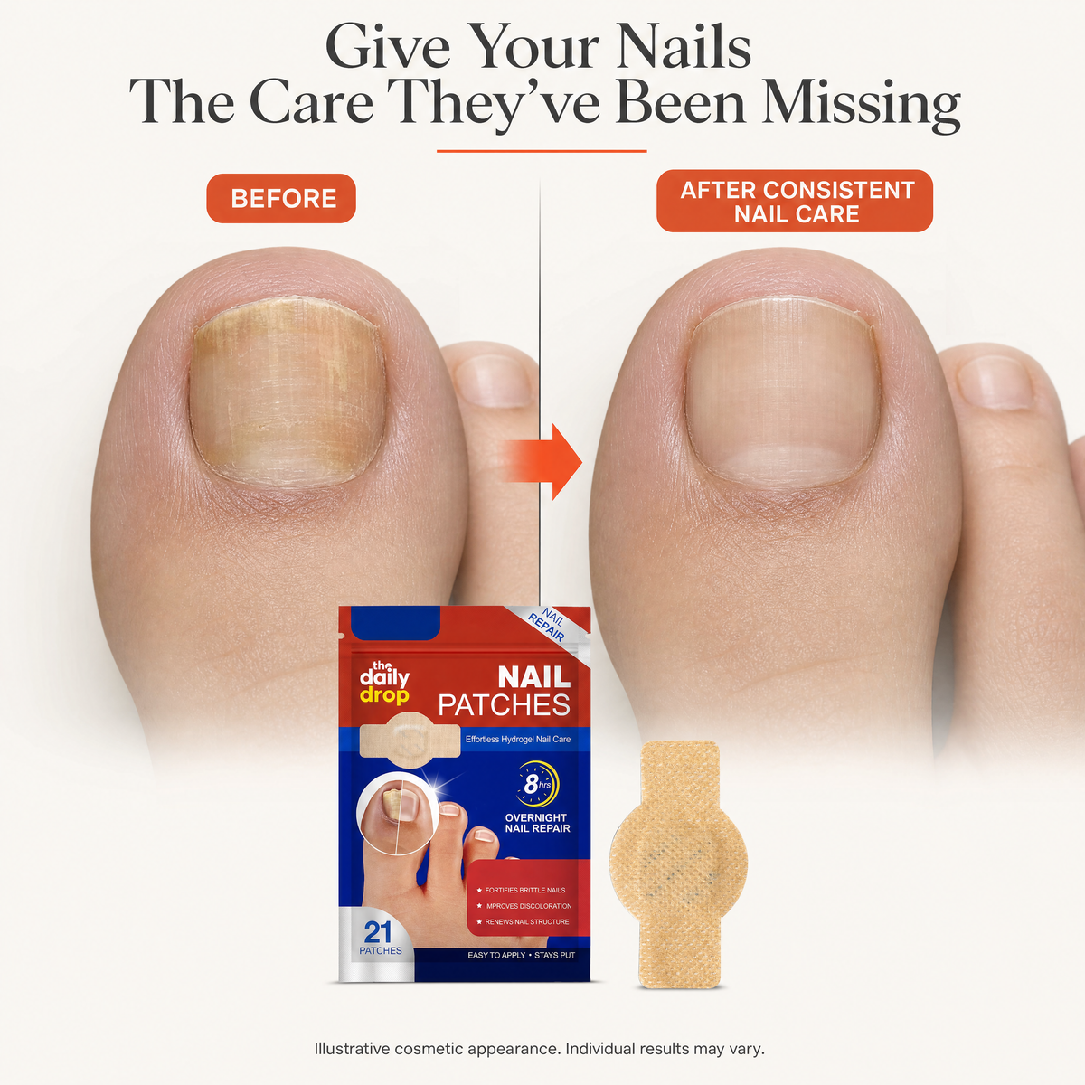Nail Fungal Repair Patches