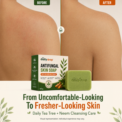 Anti-Fungal Skin Soap