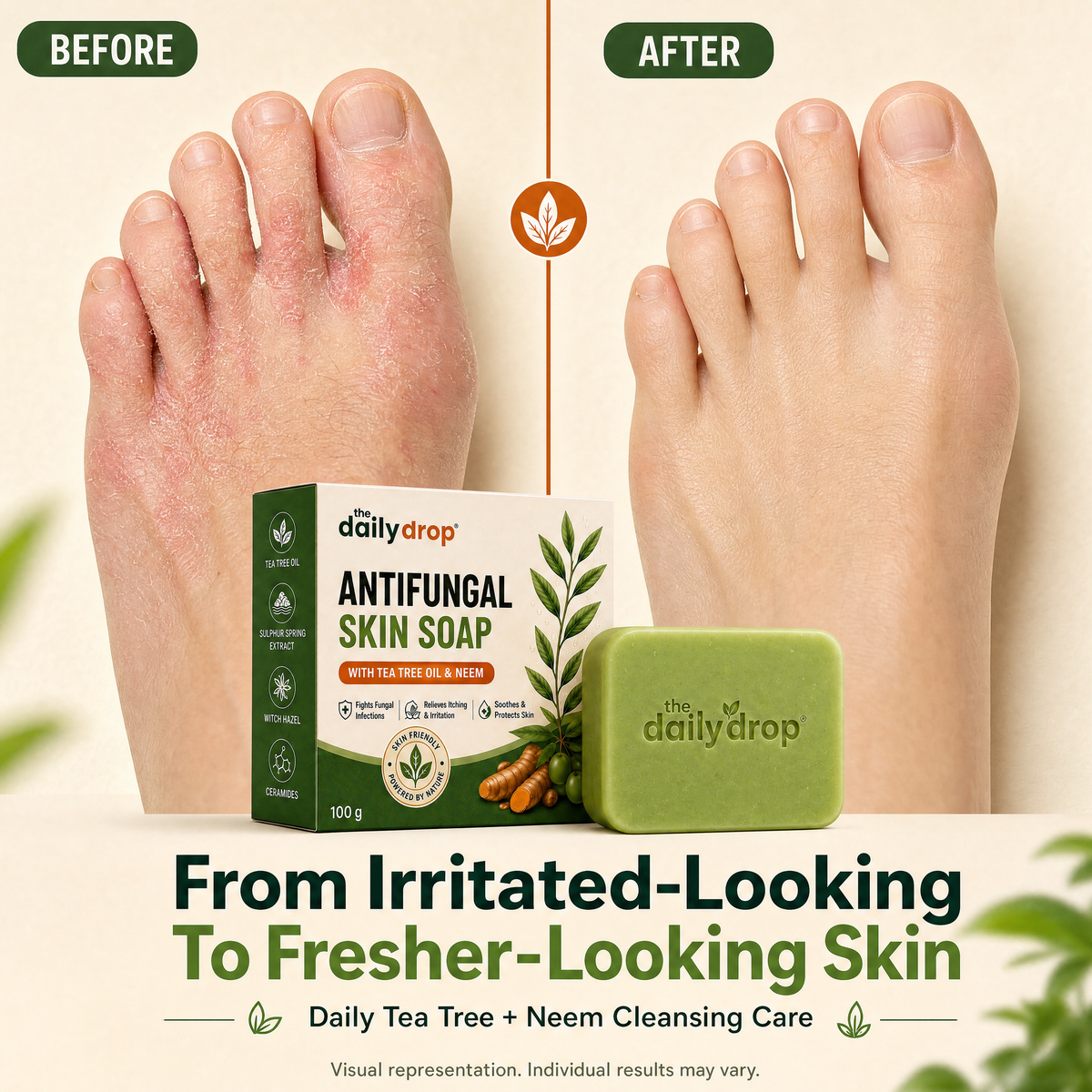 Anti-Fungal Skin Soap