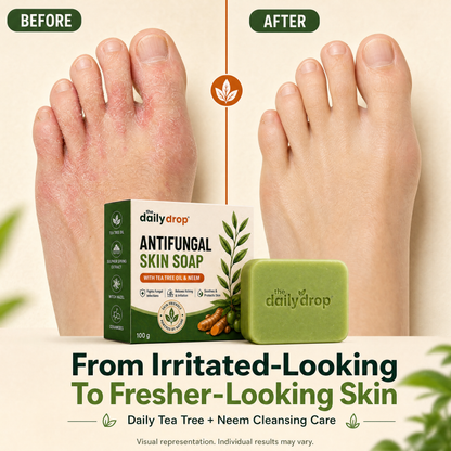 Anti-Fungal Skin Soap